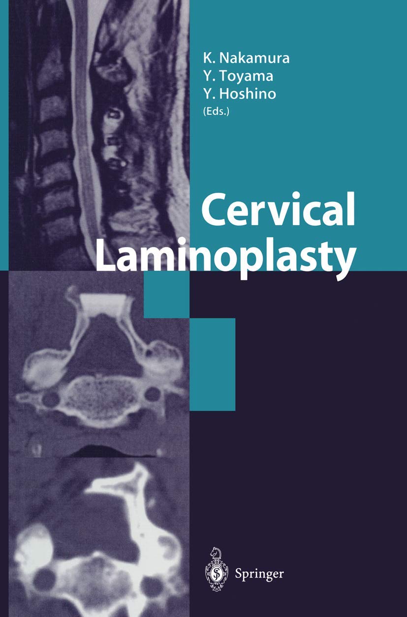 Cervical Laminoplasty,New