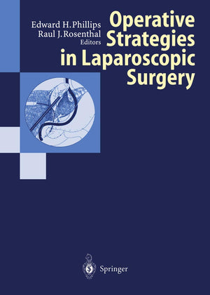 Operative Strategies In Laparoscopic Surgery,Used