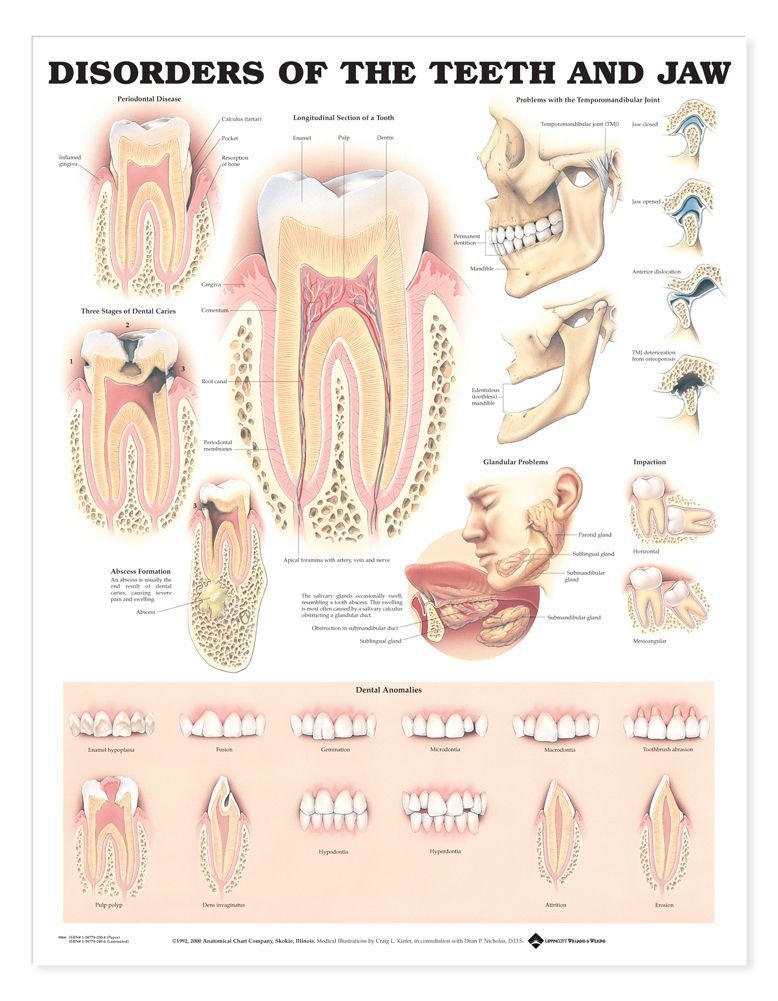 Disorders of the Teeth and Jaw Anatomical Chart,New