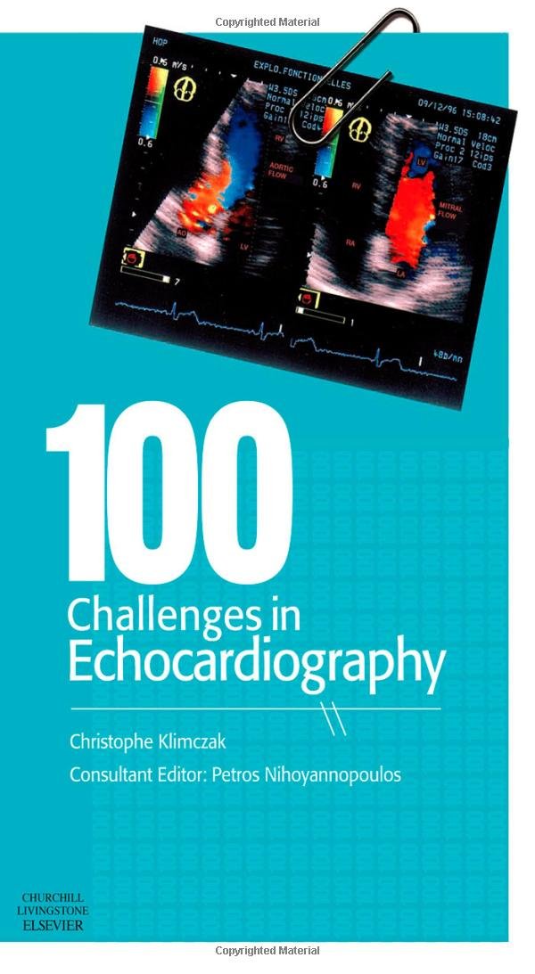100 Challenges In Echocardiography,New