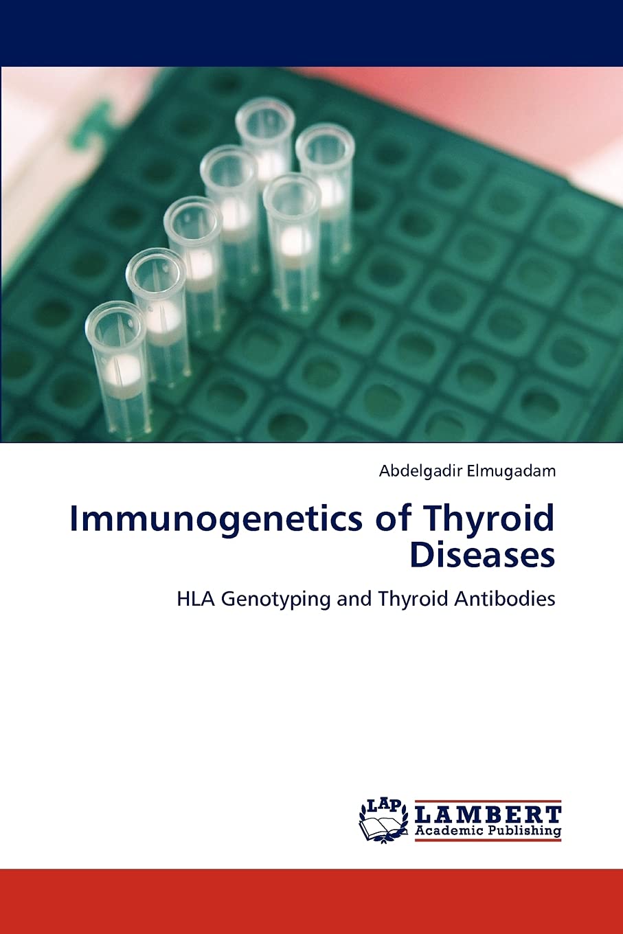 Immunogenetics of Thyroid Diseases: HLA Genotyping and Thyroid Antibodies,Used