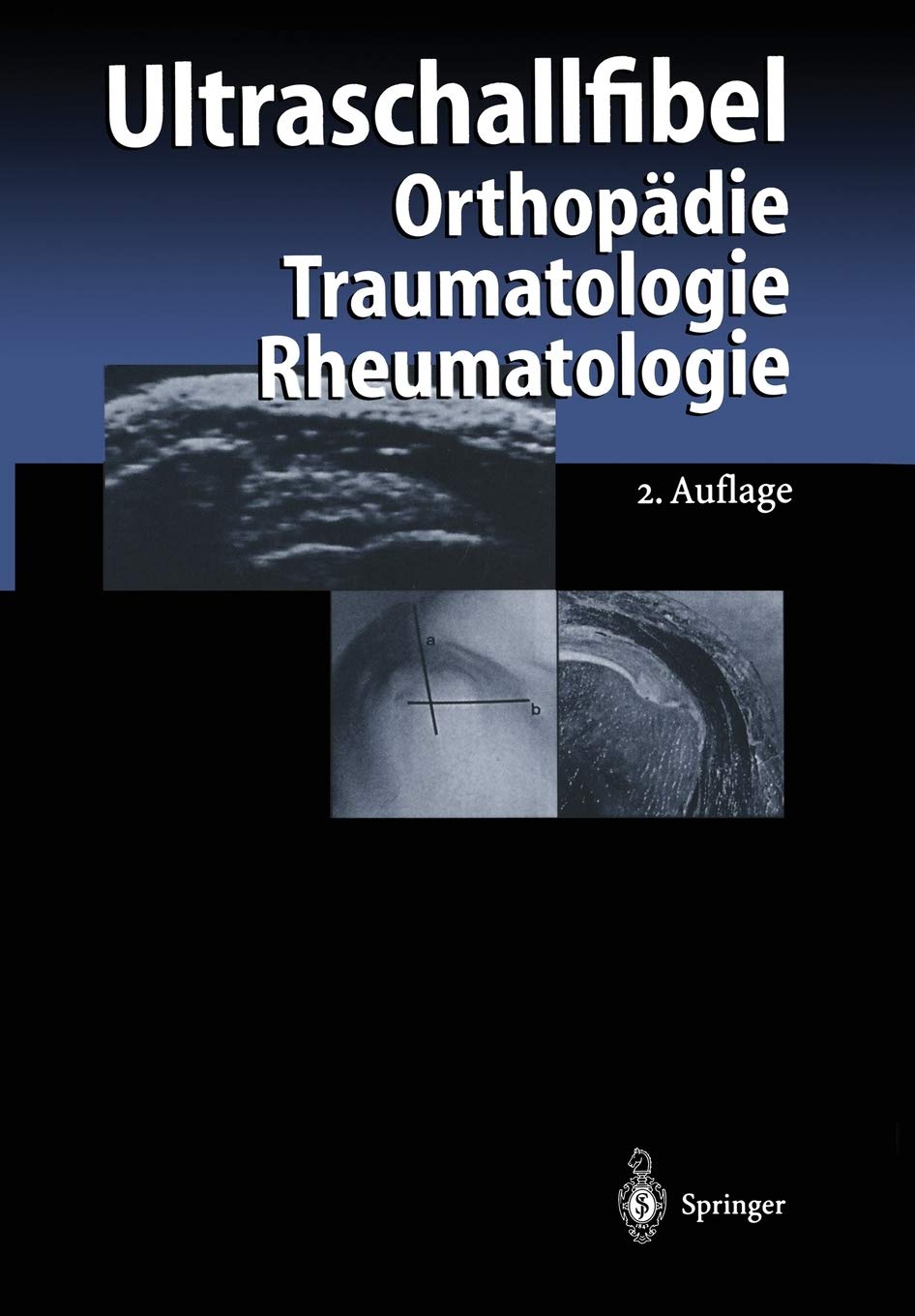 Ultraschallfibel: Orthopdie Traumatologie Rheumatologie (German Edition),Used