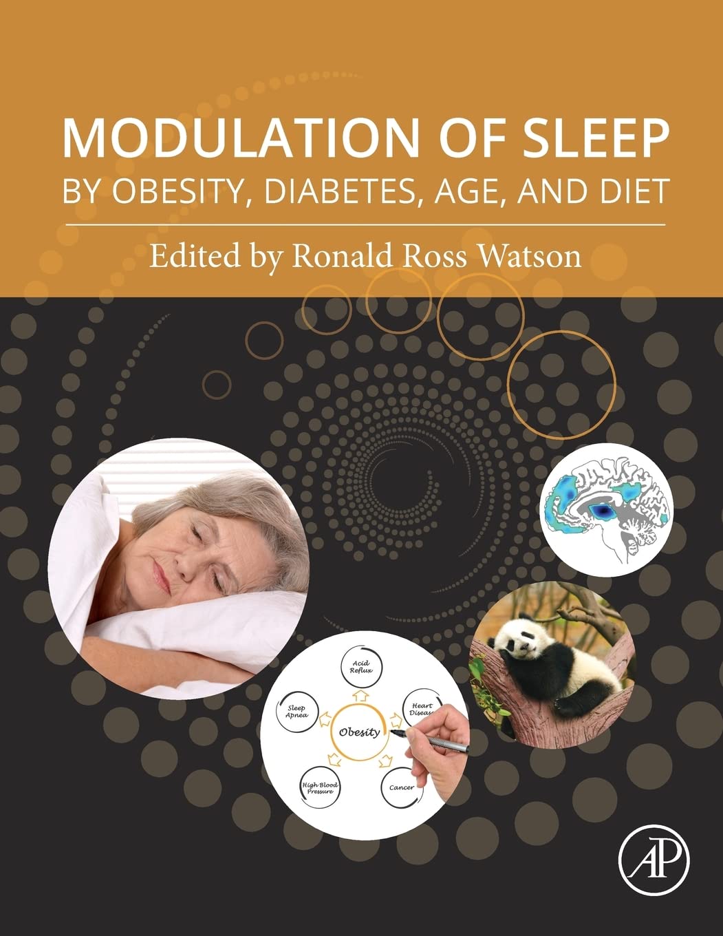 Modulation of Sleep by Obesity, Diabetes, Age, and Diet,Used