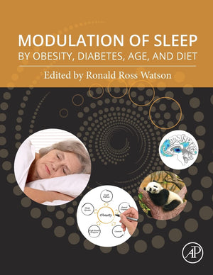 Modulation of Sleep by Obesity, Diabetes, Age, and Diet,Used