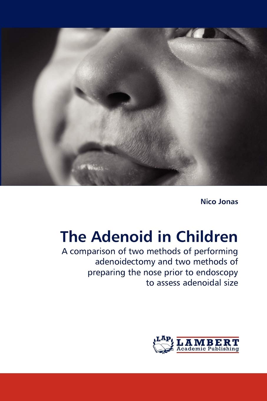 The Adenoid in Children: A comparison of two methods of performing adenoidectomy and two methods of preparing the nose prior to ,Used
