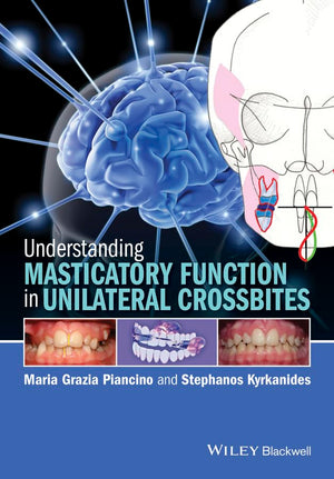 Understanding Masticatory Function in Unilateral Crossbites,Used