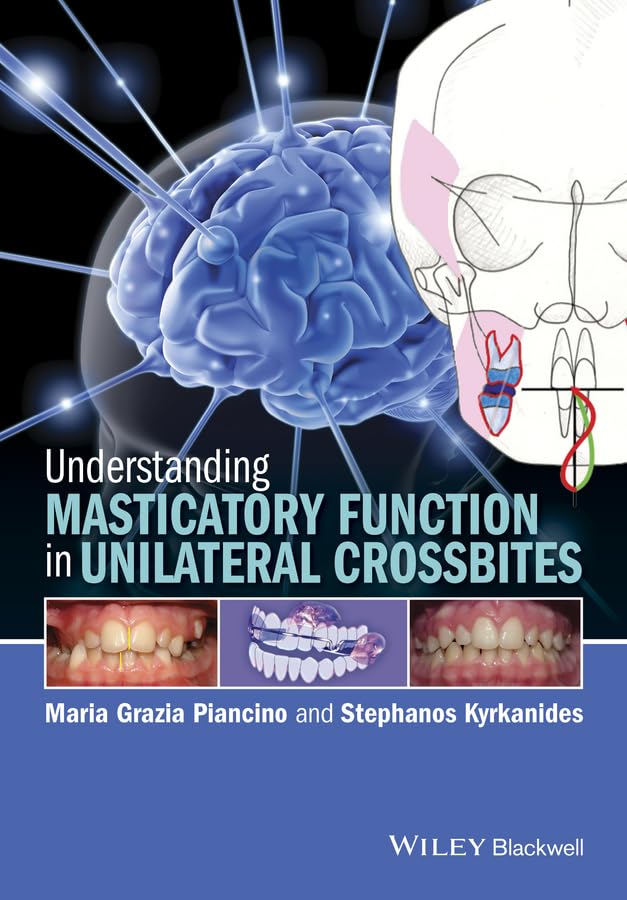 Understanding Masticatory Function in Unilateral Crossbites,Used