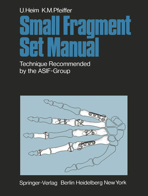 Small Fragment Set Manual: Technique Recommanded by the ASIFGroup,Used