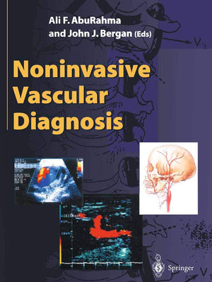 Noninvasive Vascular Diagnosis,Used
