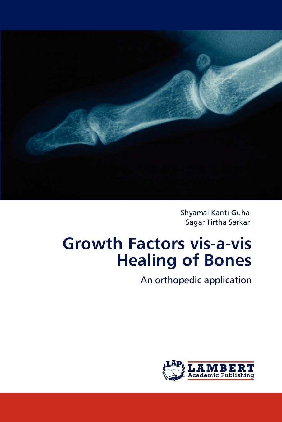 Growth Factors visavis Healing of Bones: An orthopedic application,Used