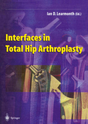 Interfaces In Total Hip Arthroplasty,Used