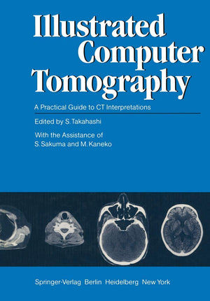 Illustrated Computer Tomography: A Practical Guide to CT Interpretations,Used