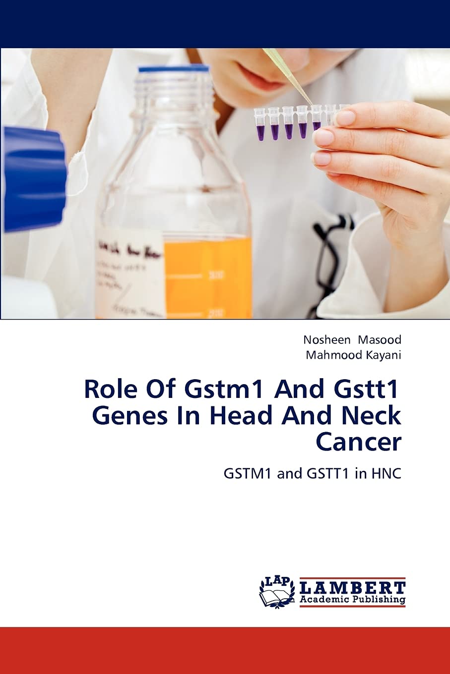 Role Of Gstm1 And Gstt1 Genes In Head And Neck Cancer: GSTM1 and GSTT1 in HNC,Used