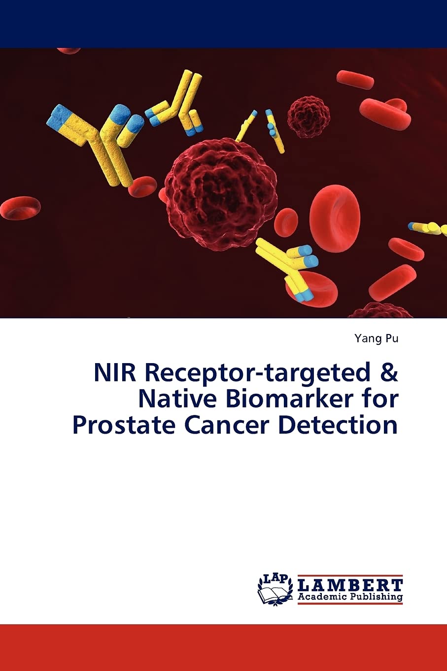 NIR Receptortargeted & Native Biomarker for Prostate Cancer Detection,Used