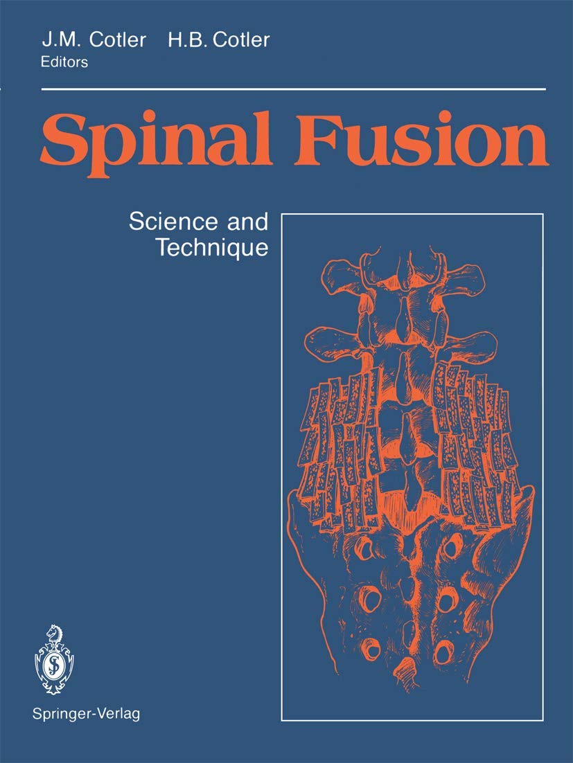Spinal Fusion: Science And Technique,Used