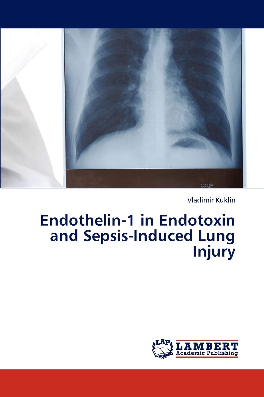 Endothelin1 in Endotoxin and SepsisInduced Lung Injury,Used