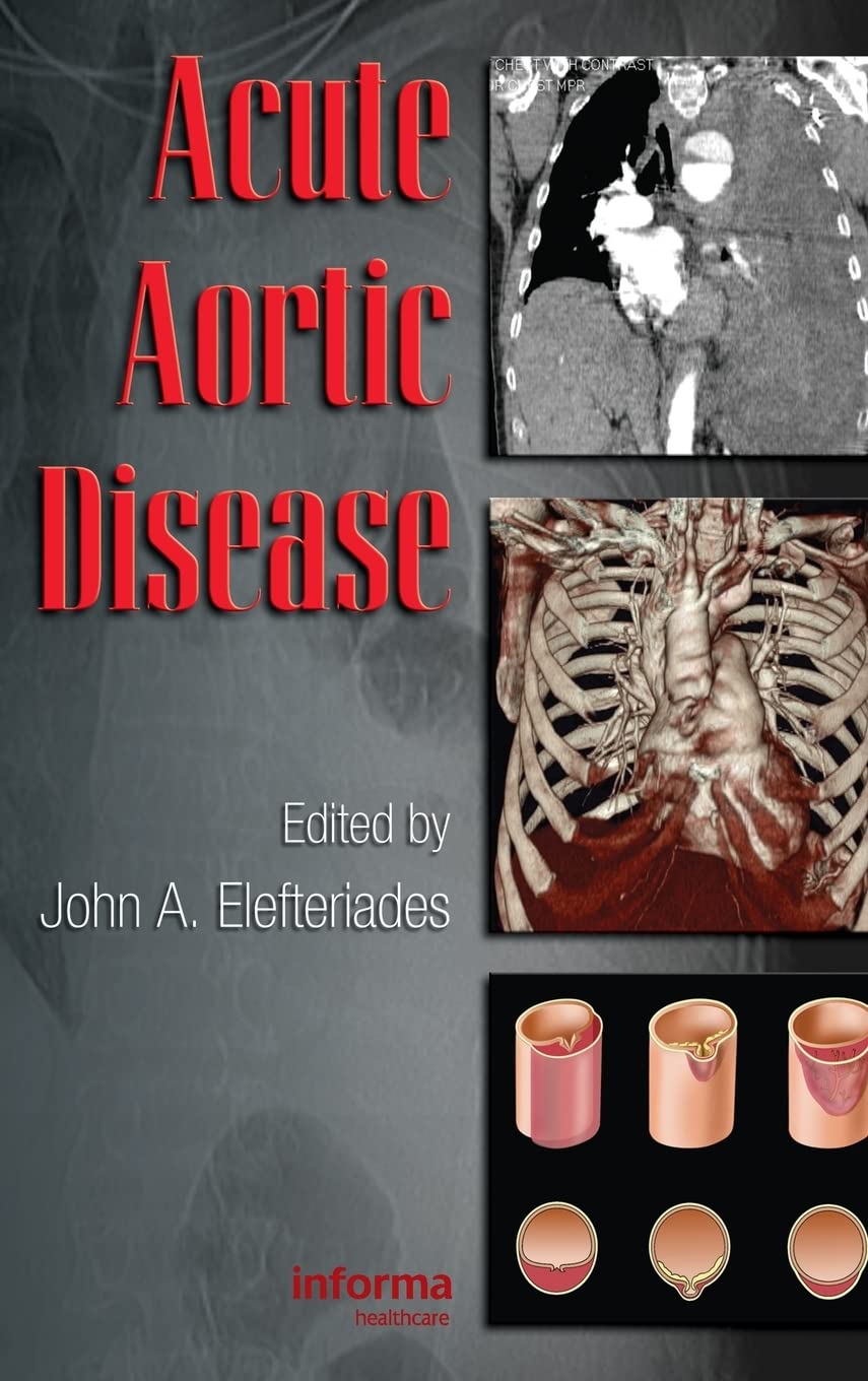 Acute Aortic Disease (Fundamental And Clinical Cardiology),Used