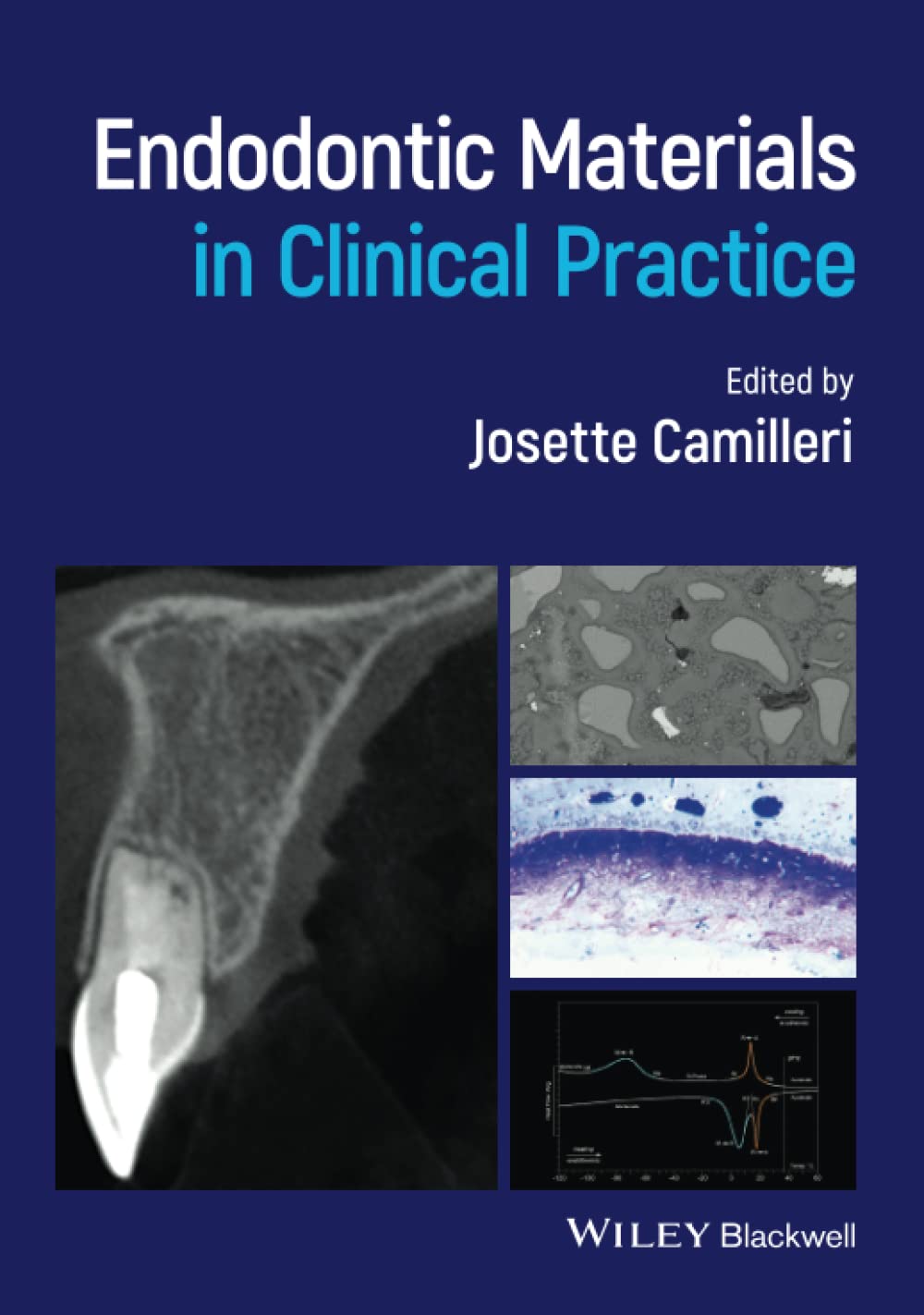 Endodontic Materials in Clinical Practice,Used