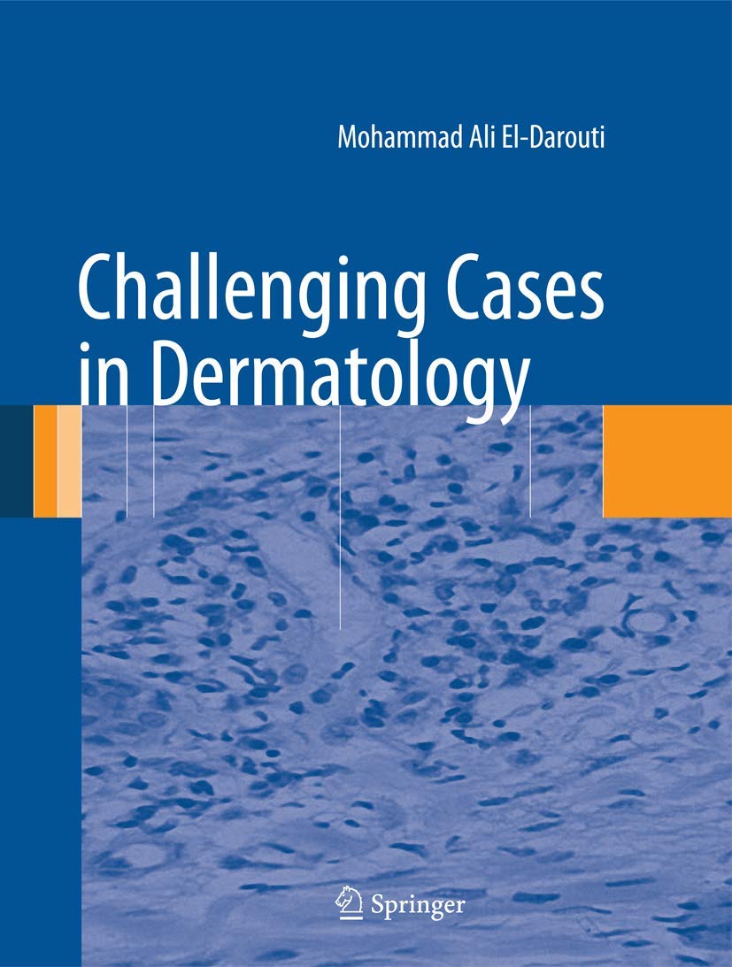 Challenging Cases In Dermatology,Used