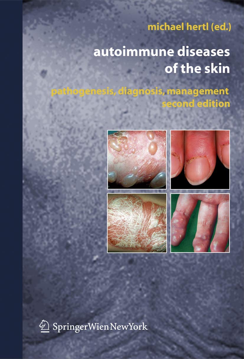 Autoimmune Diseases of the Skin: Pathogenesis, Diagnosis, Management,New