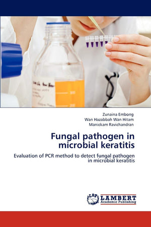 Fungal pathogen in microbial keratitis: Evaluation of PCR method to detect fungal pathogen in microbial keratitis,Used