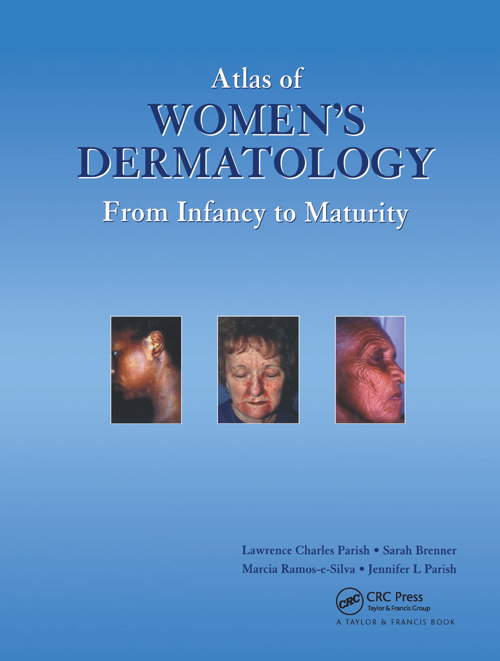 Atlas of Women's Dermatology: From Infancy to Maturity (Encyclopedia of Visual Medicine Series),Used
