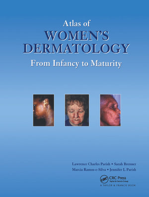 Atlas of Women's Dermatology: From Infancy to Maturity (Encyclopedia of Visual Medicine Series),Used