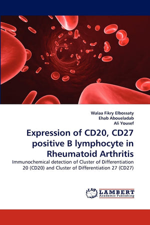 Expression of CD20, CD27 positive B lymphocyte in Rheumatoid Arthritis: Immunochemical detection of Cluster of Differentiation 2,Used