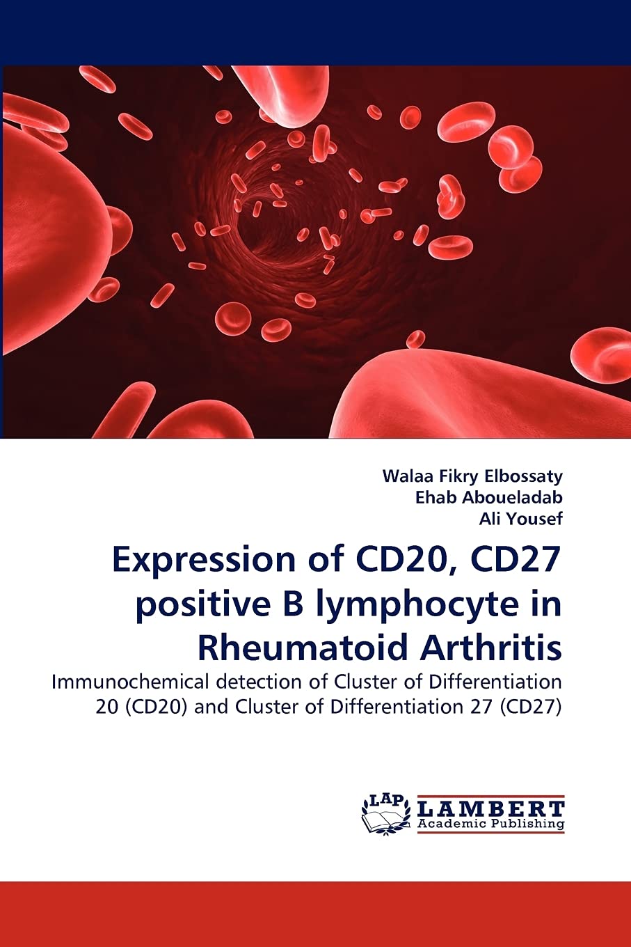 Expression of CD20, CD27 positive B lymphocyte in Rheumatoid Arthritis: Immunochemical detection of Cluster of Differentiation 2,Used