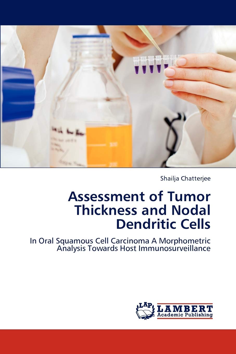 Assessment of Tumor Thickness and Nodal Dendritic Cells: In Oral Squamous Cell Carcinoma A Morphometric Analysis Towards Host Im,Used