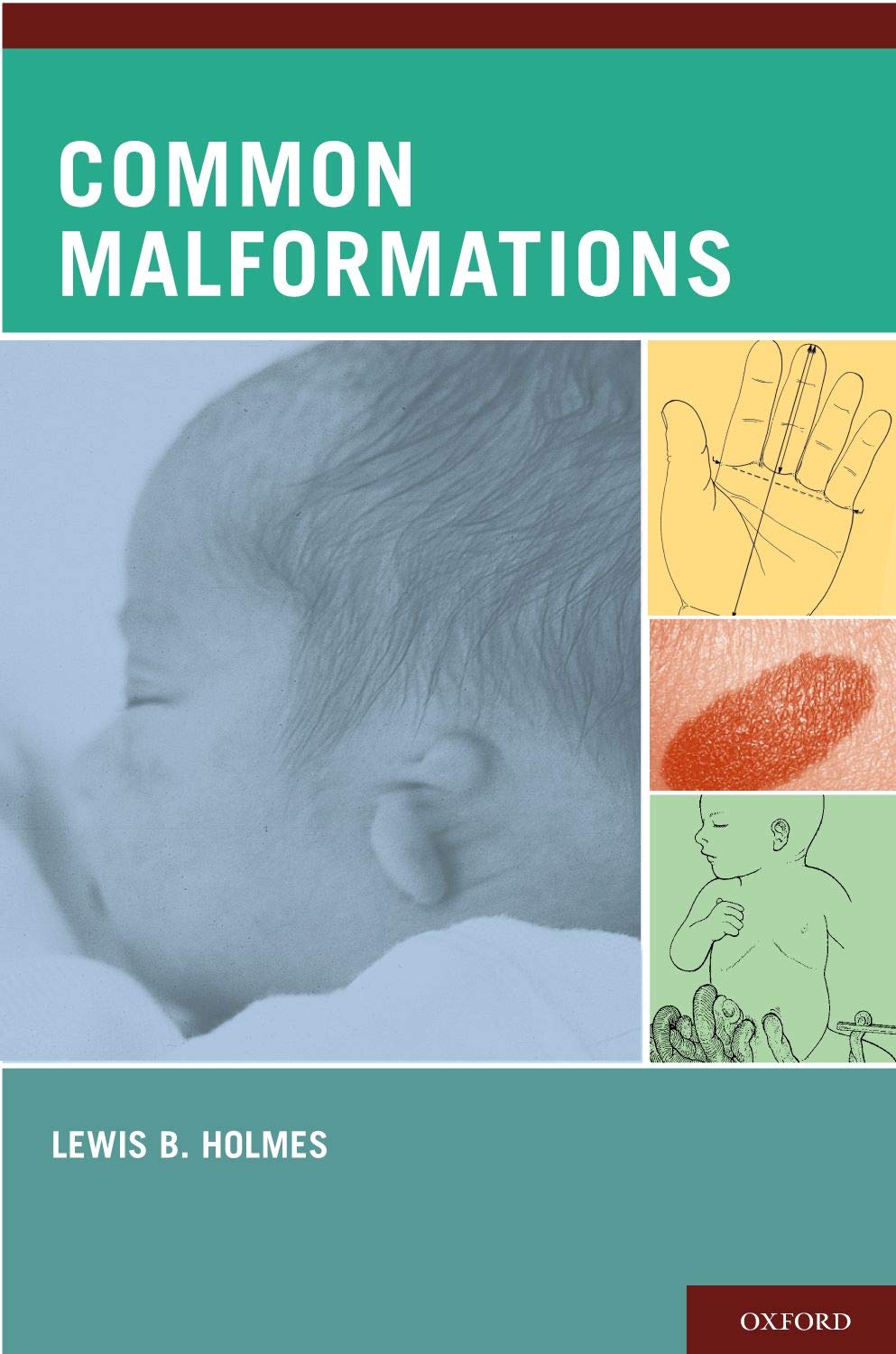 Common Malformations,Used