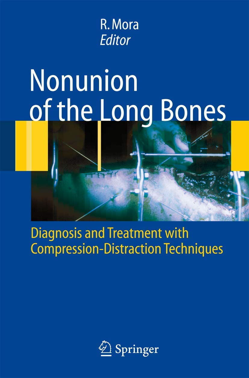 Nonunion of the Long Bones: Diagnosis and treatment with compressiondistraction techniques,New