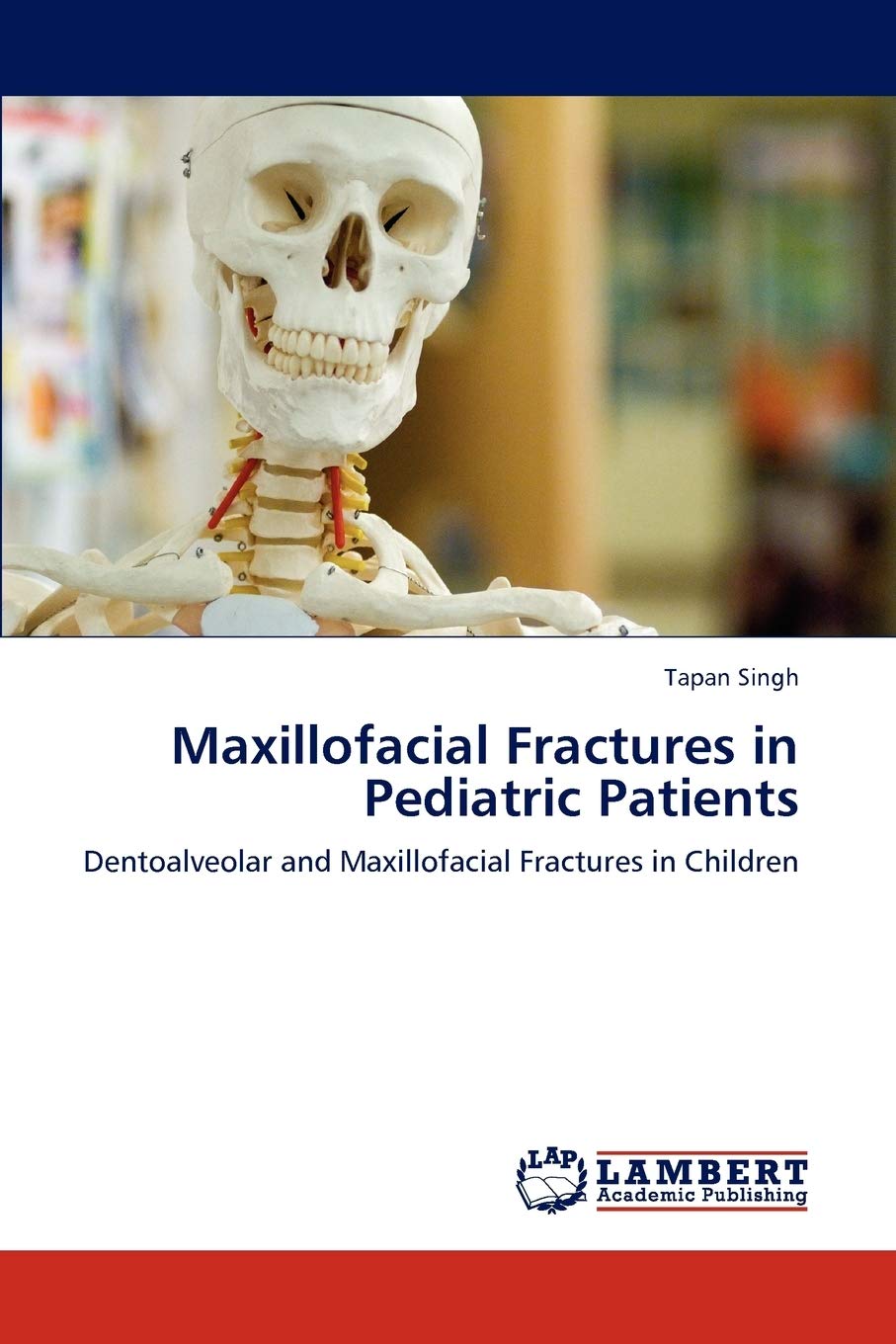 Maxillofacial Fractures in Pediatric Patients: Dentoalveolar and Maxillofacial Fractures in Children,Used