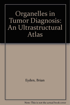 Organelles in Tumor Diagnosis: An Ultrastructural Atlas,Used
