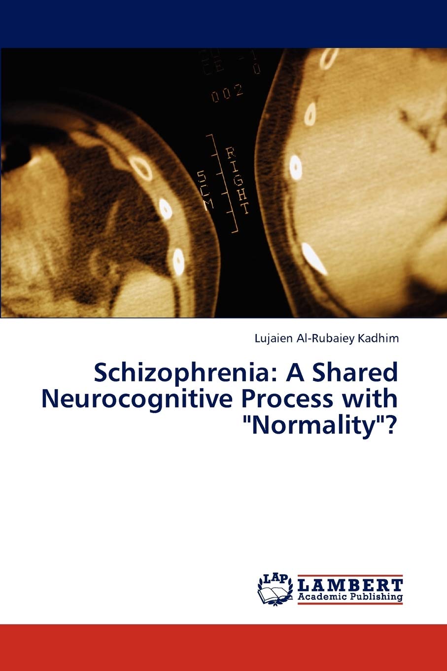 Schizophrenia: A Shared Neurocognitive Process with 