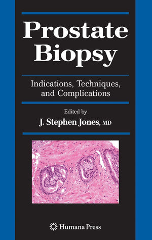 Prostate Biopsy: Indications, Techniques, and Complications (Current Clinical Urology),Used