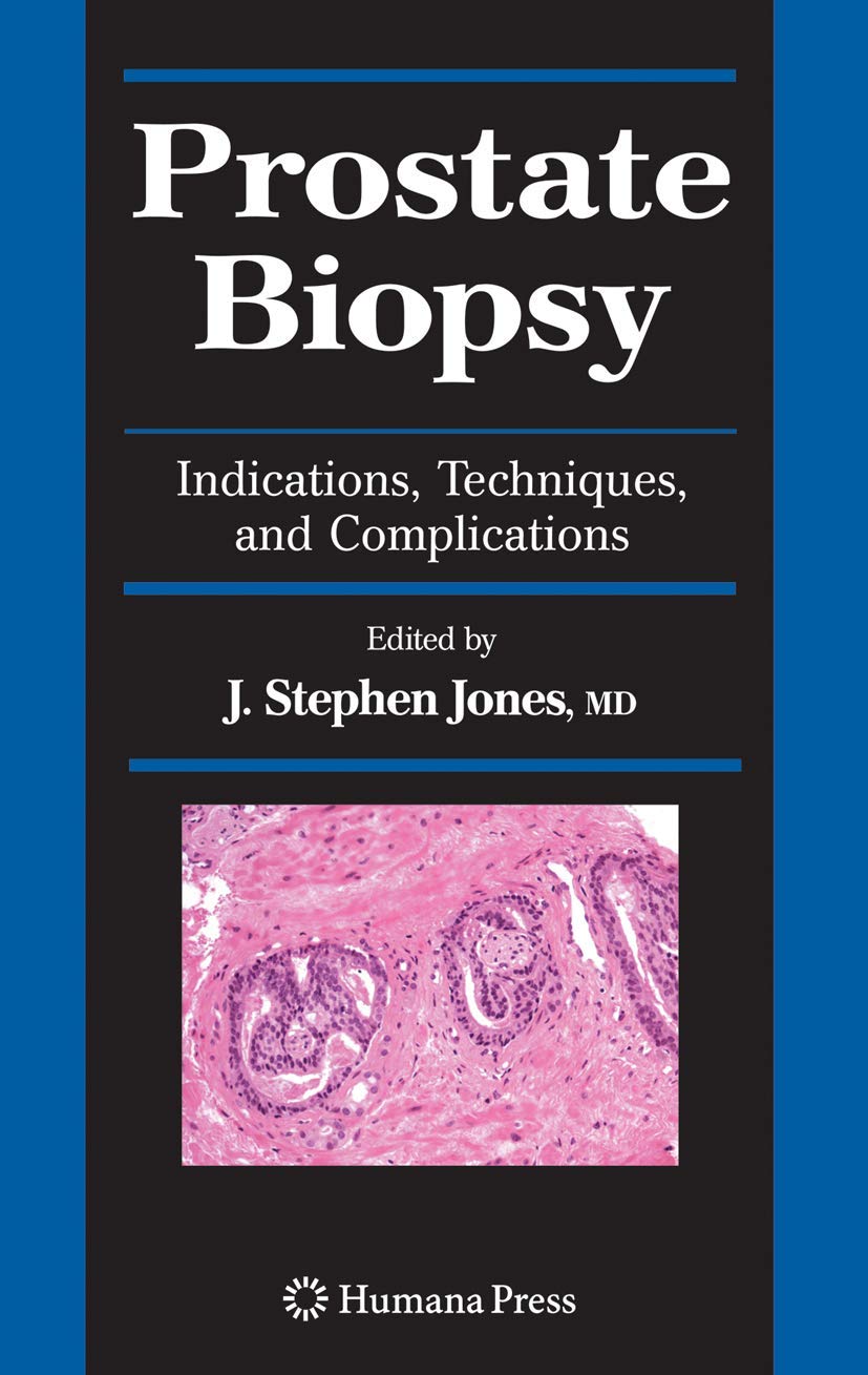 Prostate Biopsy: Indications, Techniques, and Complications (Current Clinical Urology),Used