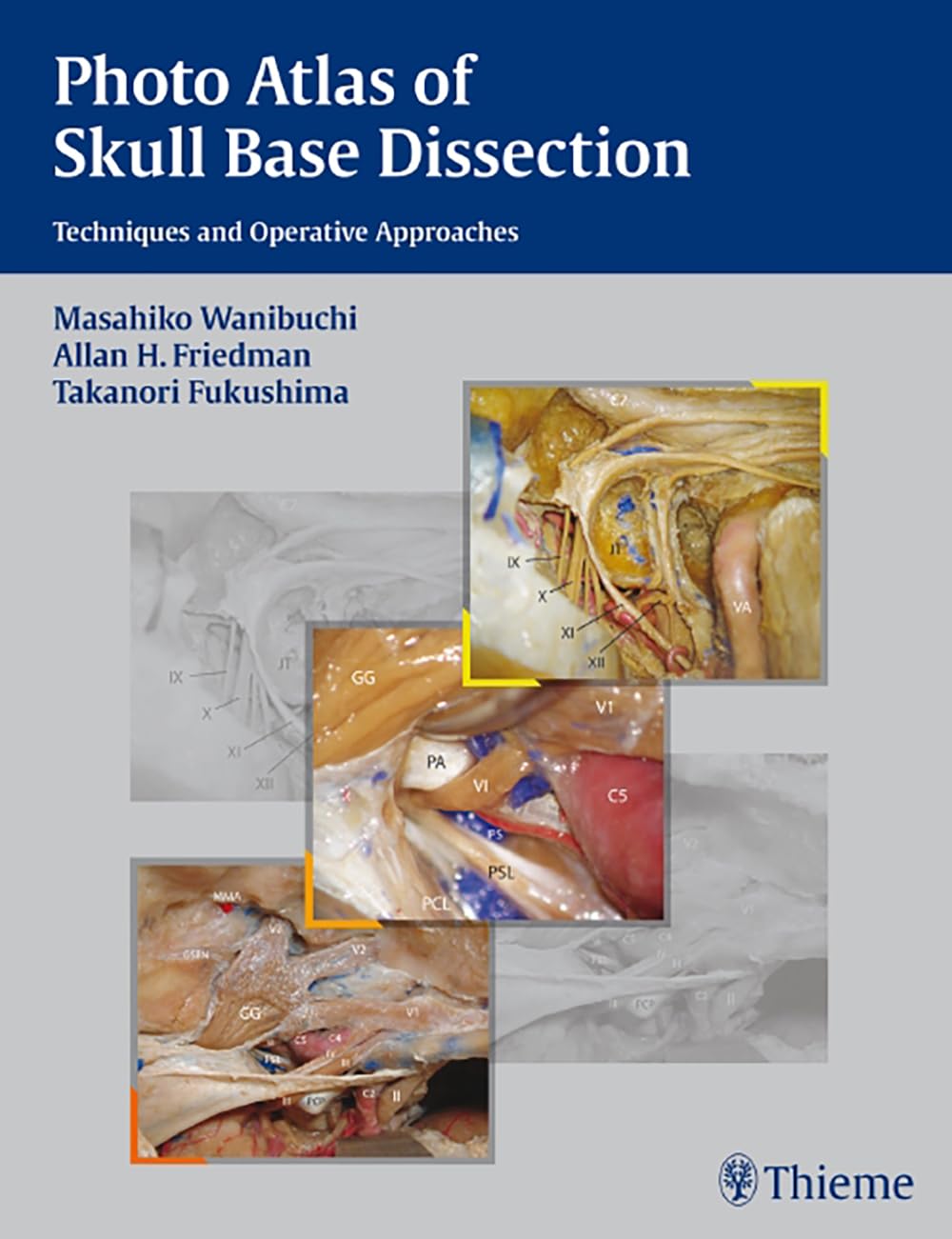 Photo Atlas of Skull Base Dissection: Techniques and Operative Approaches,Used