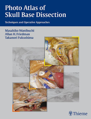 Photo Atlas of Skull Base Dissection: Techniques and Operative Approaches,Used