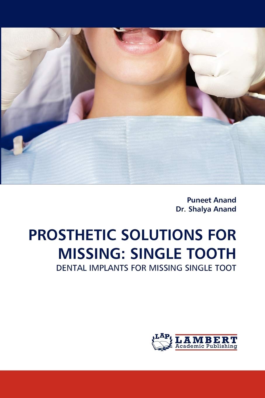 PROSTHETIC SOLUTIONS FOR MISSING: SINGLE TOOTH: DENTAL IMPLANTS FOR MISSING SINGLE TOOT,Used