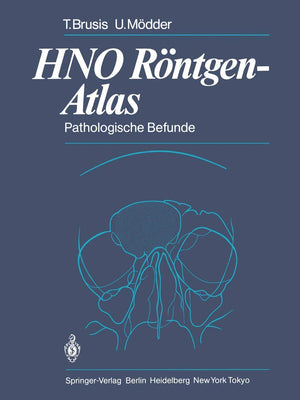 Hno Rntgenatlas: Pathologische Befunde (German Edition),Used