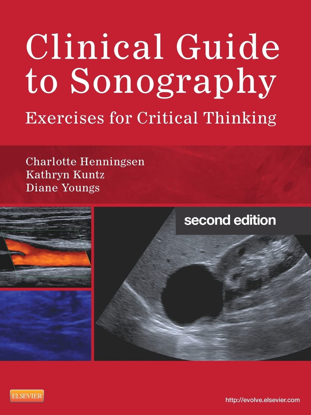Clinical Guide To Sonography