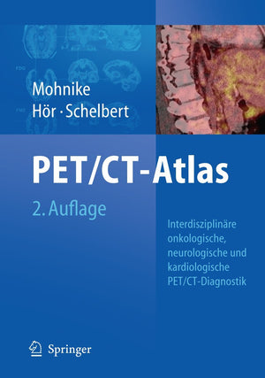 Oncologic and Cardiologic PET/CTDiagnosis: An Interdisciplinary Atlas and Manual,Used