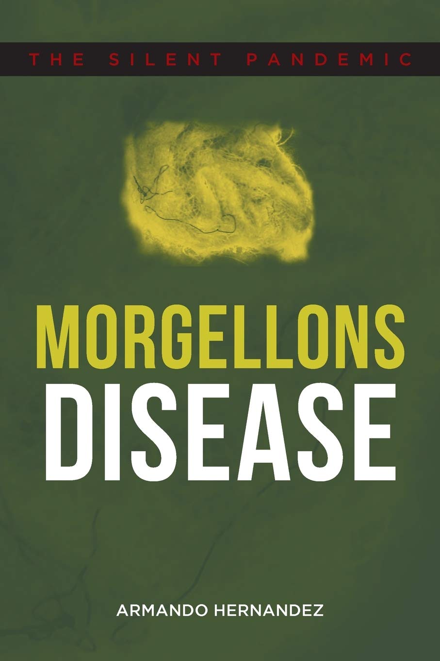Morgellons Disease: The Silent Pandemic,Used