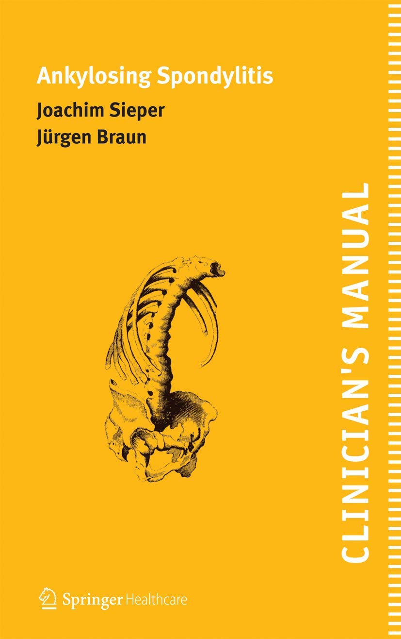 Clinician'S Manual On Ankylosing Spondylitis,Used