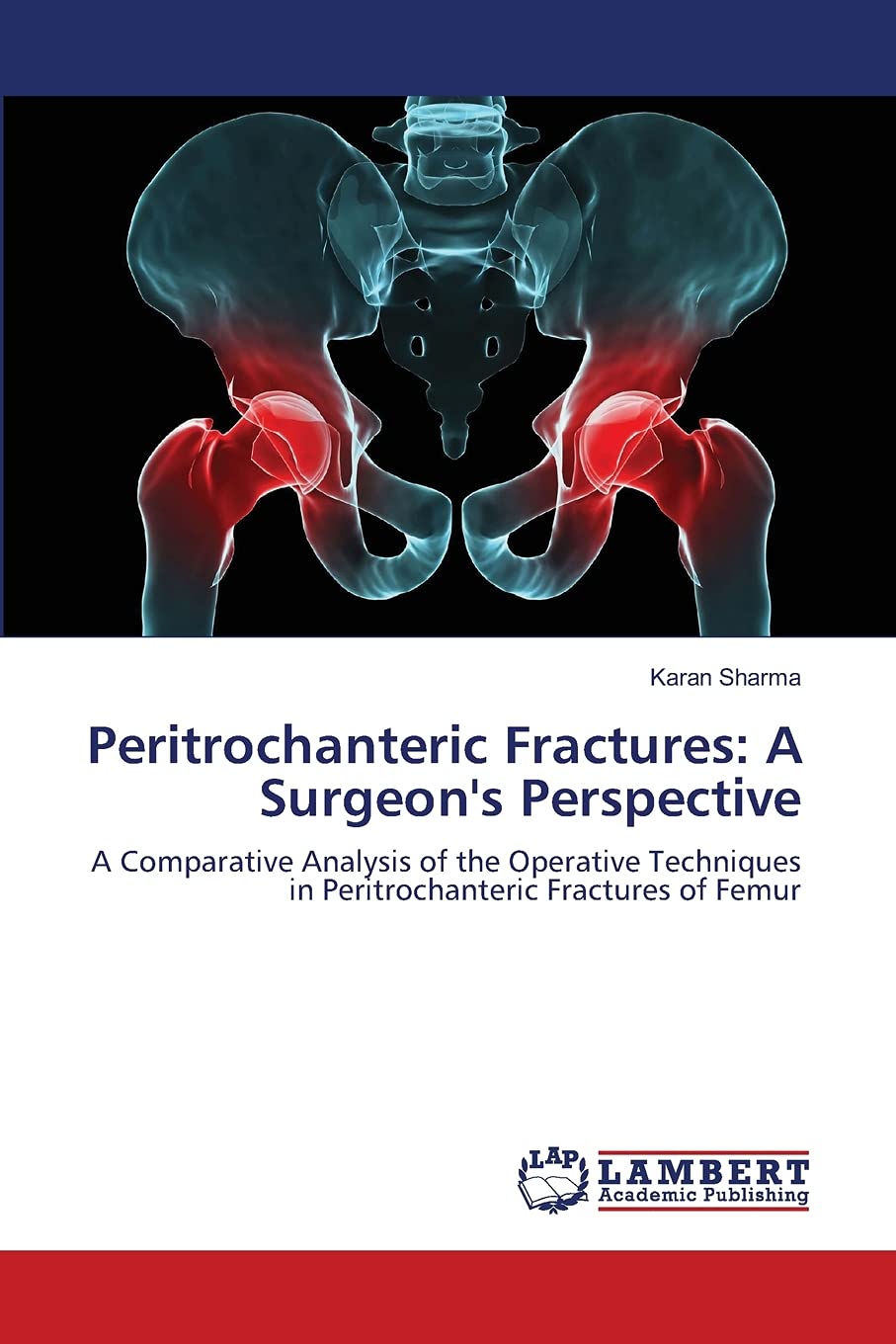 Peritrochanteric Fractures: A Surgeon's Perspective: A Comparative Analysis of the Operative Techniques in Peritrochanteric Frac,Used