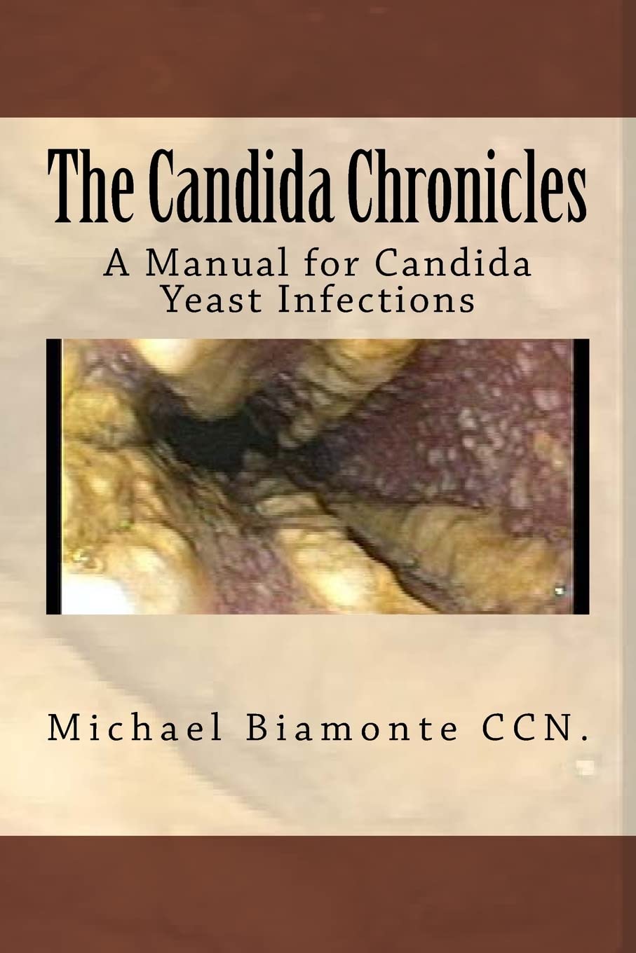 The Candida Chronicles: A Manual For Candida Yeast Infections,Used