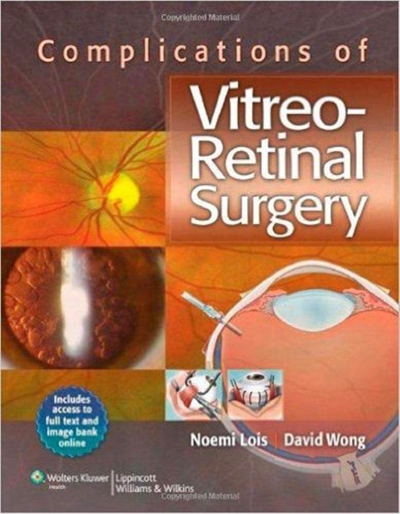 Complications of VitreoRetinal Surgery,Used