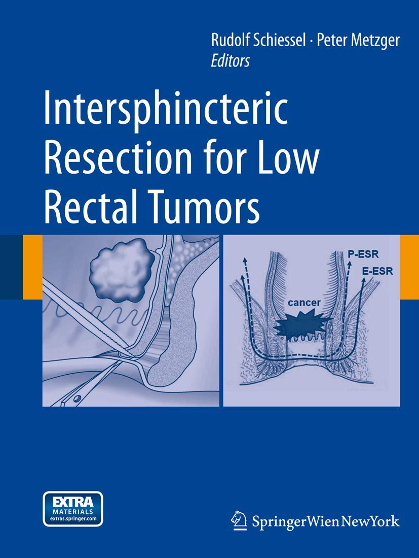 Intersphincteric Resection for Low Rectal Tumors,Used