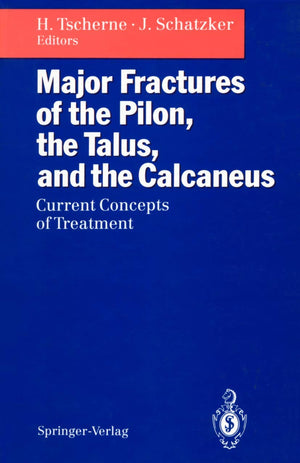 Major Fractures of the Pilon, the Talus, and the Calcaneus: Current Concepts of Treatment,Used